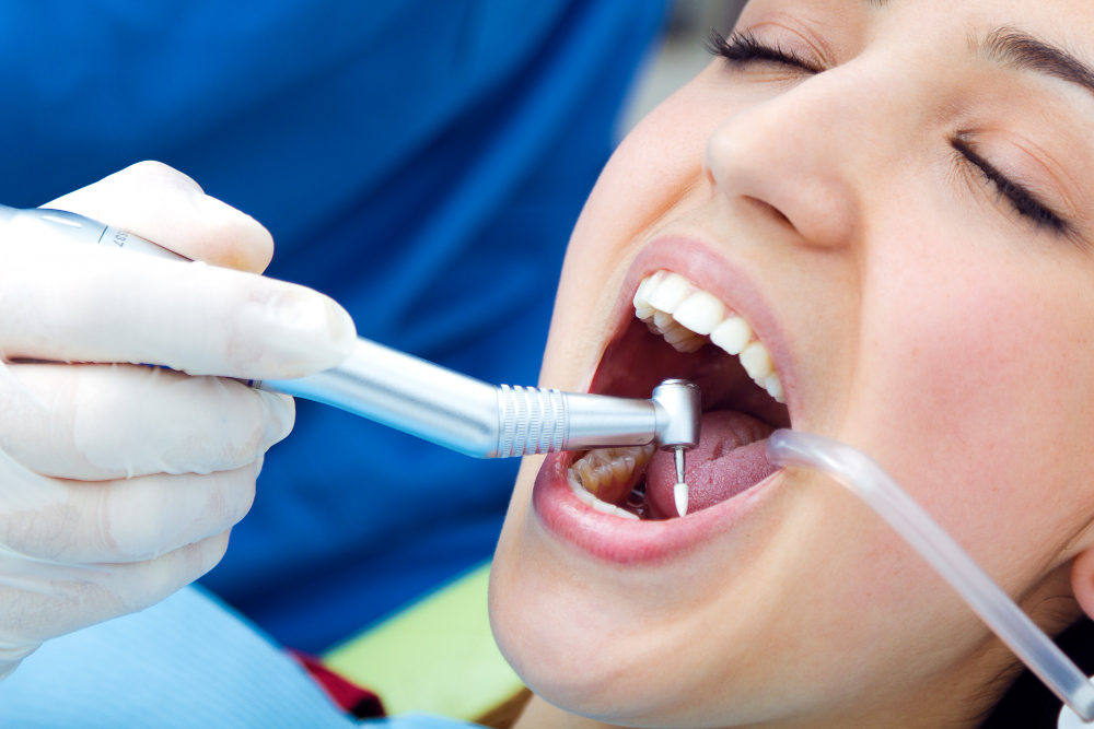 Teeth Extraction in Scarborough