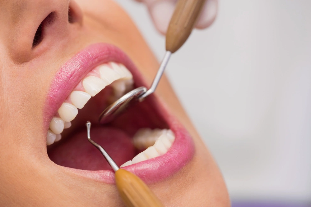 Guide to the Best Teeth Whitening Services in Scarborough, ON